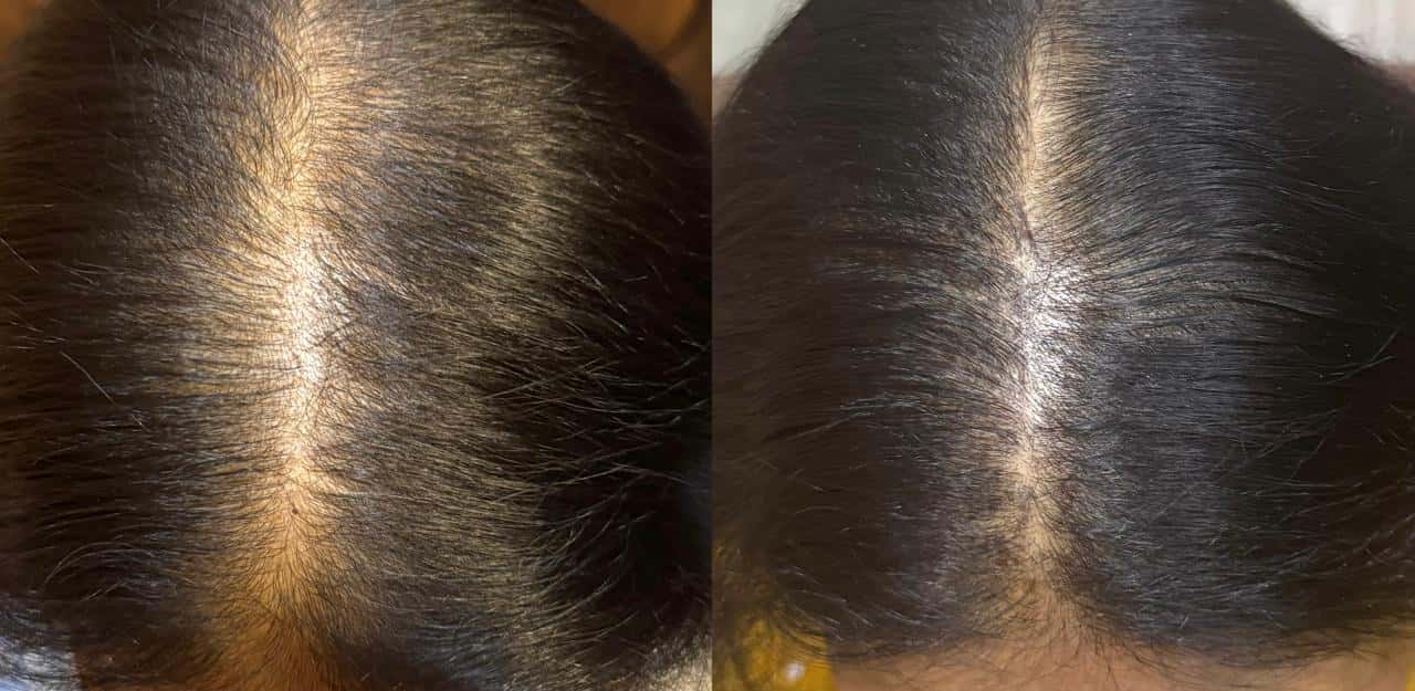 Hair GFC Result 1