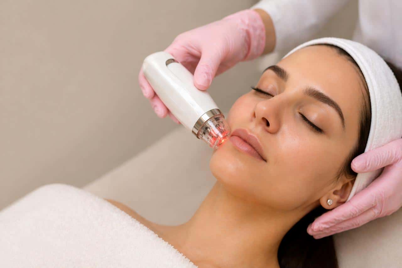 MNRF Treatment